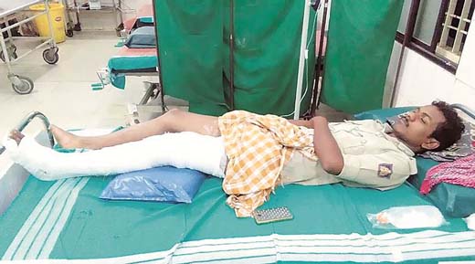 legfracture16 jul 18